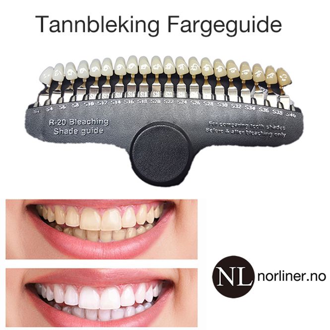 Hovedbilde TF-Tannbleking Fargeguide